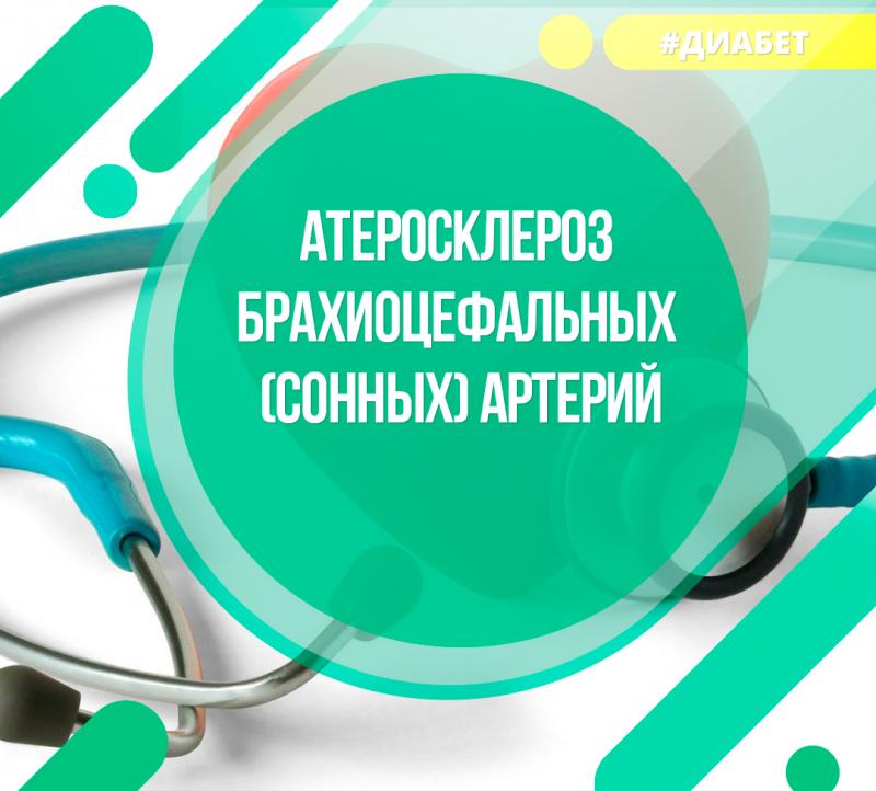 Атеросклероз брахиоцеф (сонных) артерий